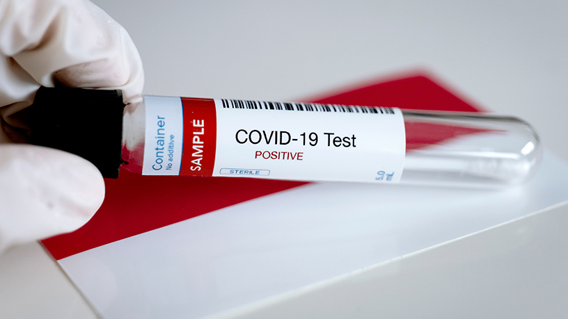 East Ventures raises funds, teams up with state agency to produce Covid-19 tests for Indonesia