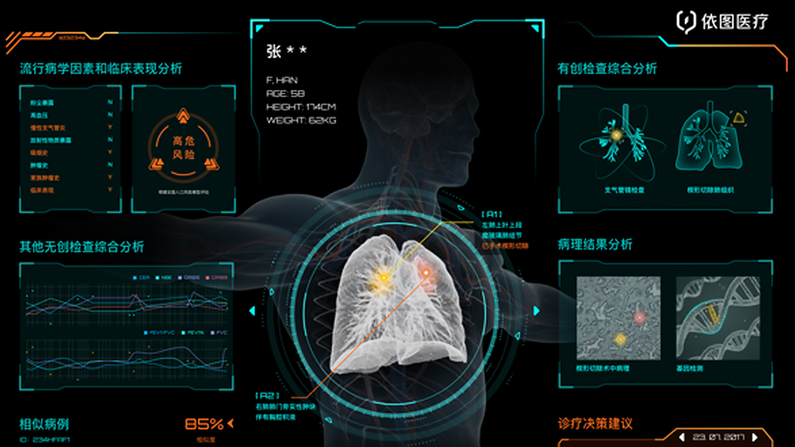 YITU takes smart healthcare to the next level